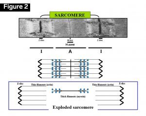 sarcomere, neuropathology