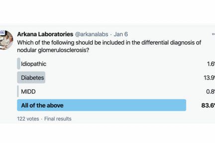 nodular glomerulosclerosis, renal pathology, arkana laboratories, kidney disease