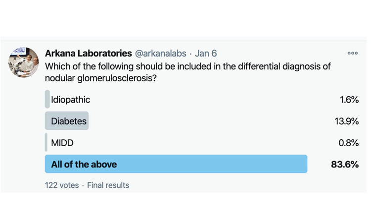 nodular glomerulosclerosis, renal pathology, arkana laboratories, kidney disease
