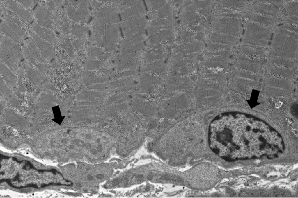 Satellite Cells Neuro Notes Arkana Laboratories