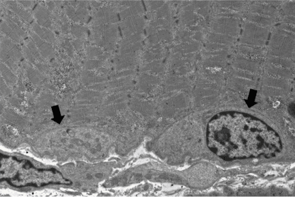 Satellite Cells, Neuro Notes, neuropathology, arkana laboratories