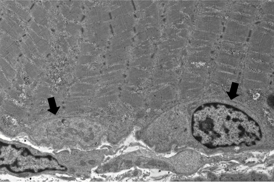 Satellite Cells, Neuro Notes, neuropathology, arkana laboratories