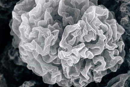 Subpodcocytic Capillary Loop Basement Membranes After Removal of Podocytes