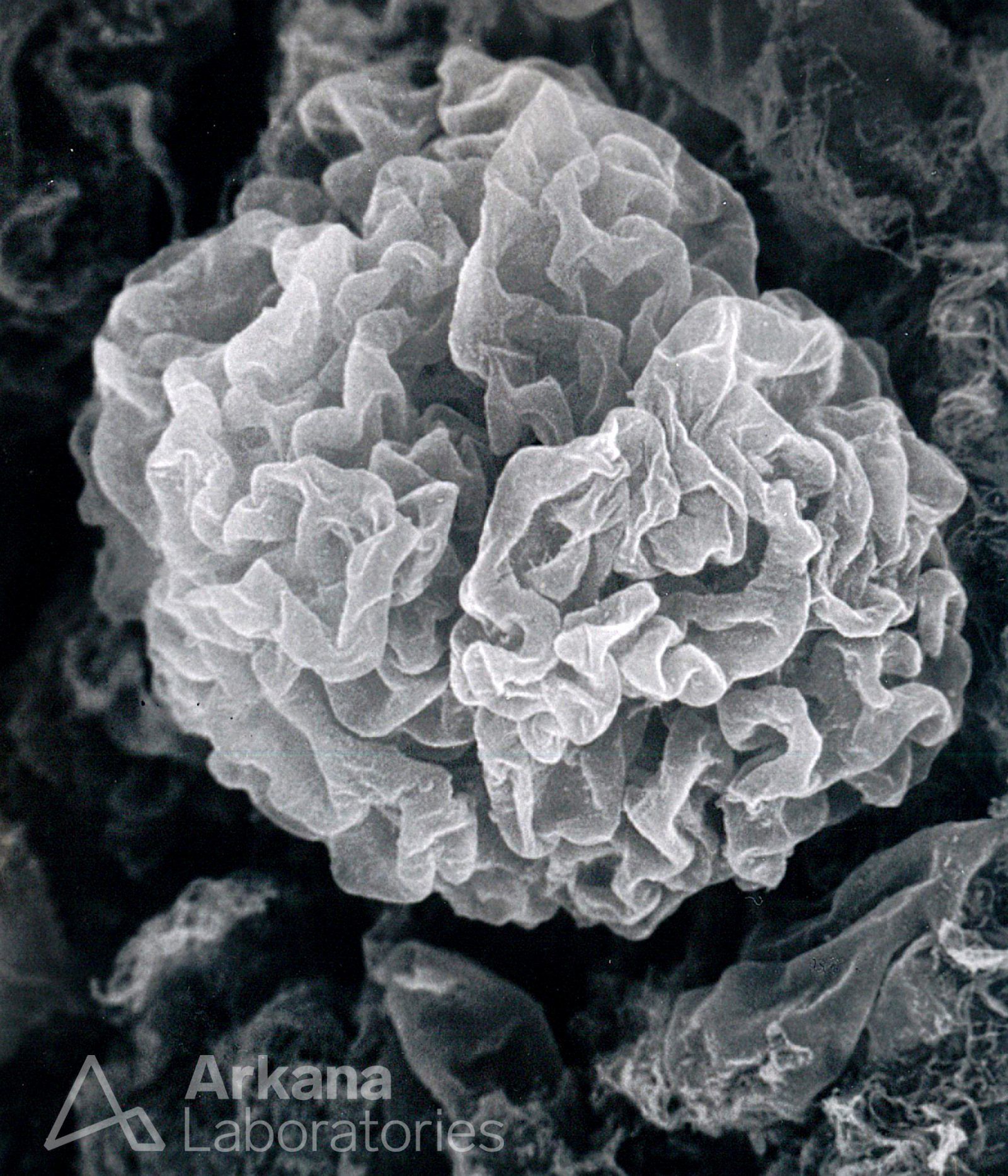 Subpodcocytic Capillary Loop Basement Membranes After Removal of Podocytes