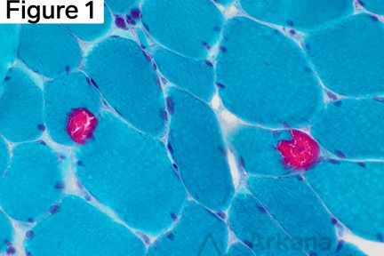 Modified Gomori Trichrome (MGT)