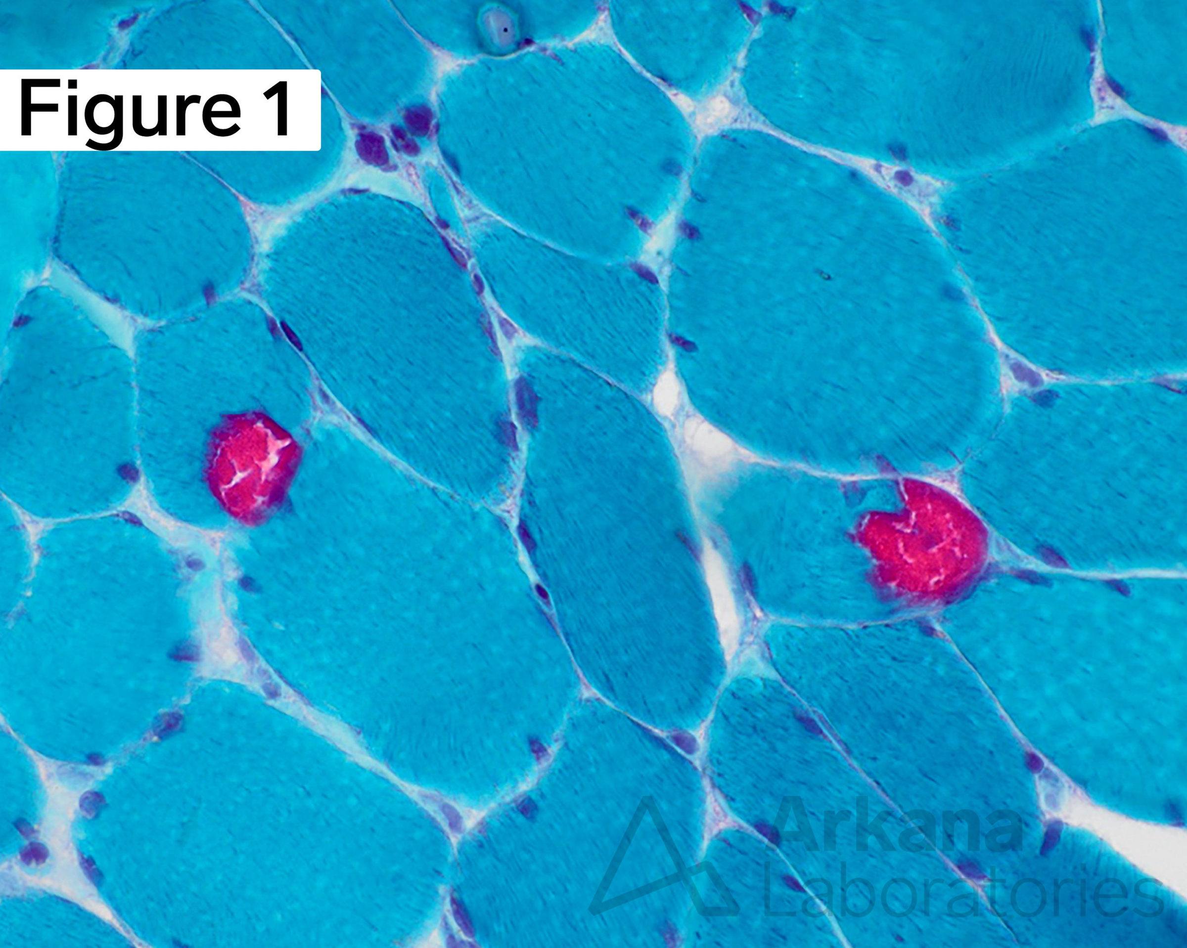 Modified Gomori Trichrome (MGT)