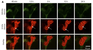 Glomerular barrier, disease week, arkana laboratories