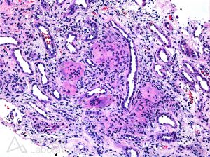 renal pathology stain at Arkana Laboratories