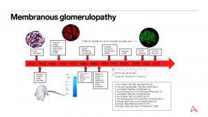 Membranous glomerulopathy chart by arkana laboratories