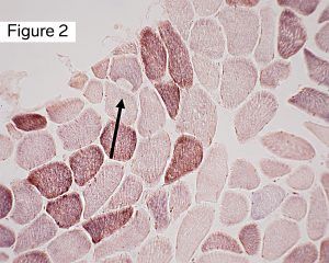 Modified Gomori Trichrome (MGT)