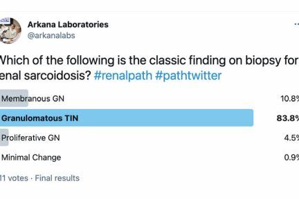 Granulomatous TIN, twitter poll, arkana laboratories