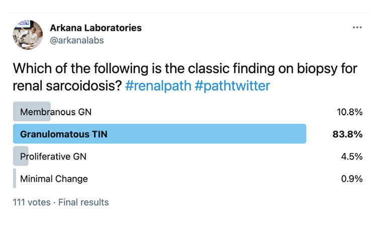 Granulomatous TIN, twitter poll, arkana laboratories