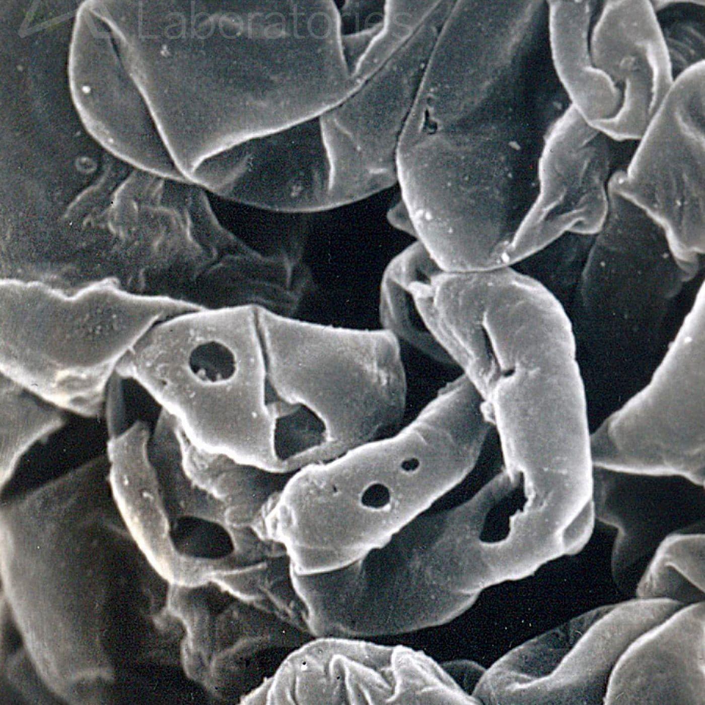Dysmorphic Red Blood Cells | eyeSCANdy | Arkana Laboratories