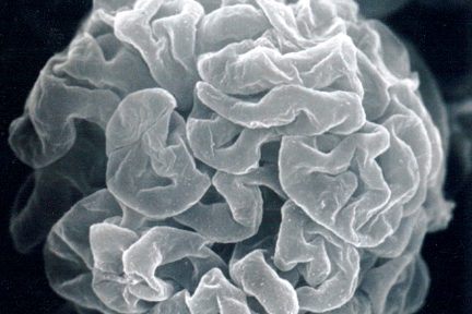 subpodcocytic capillary loop basement membranes following removal of the podocytes