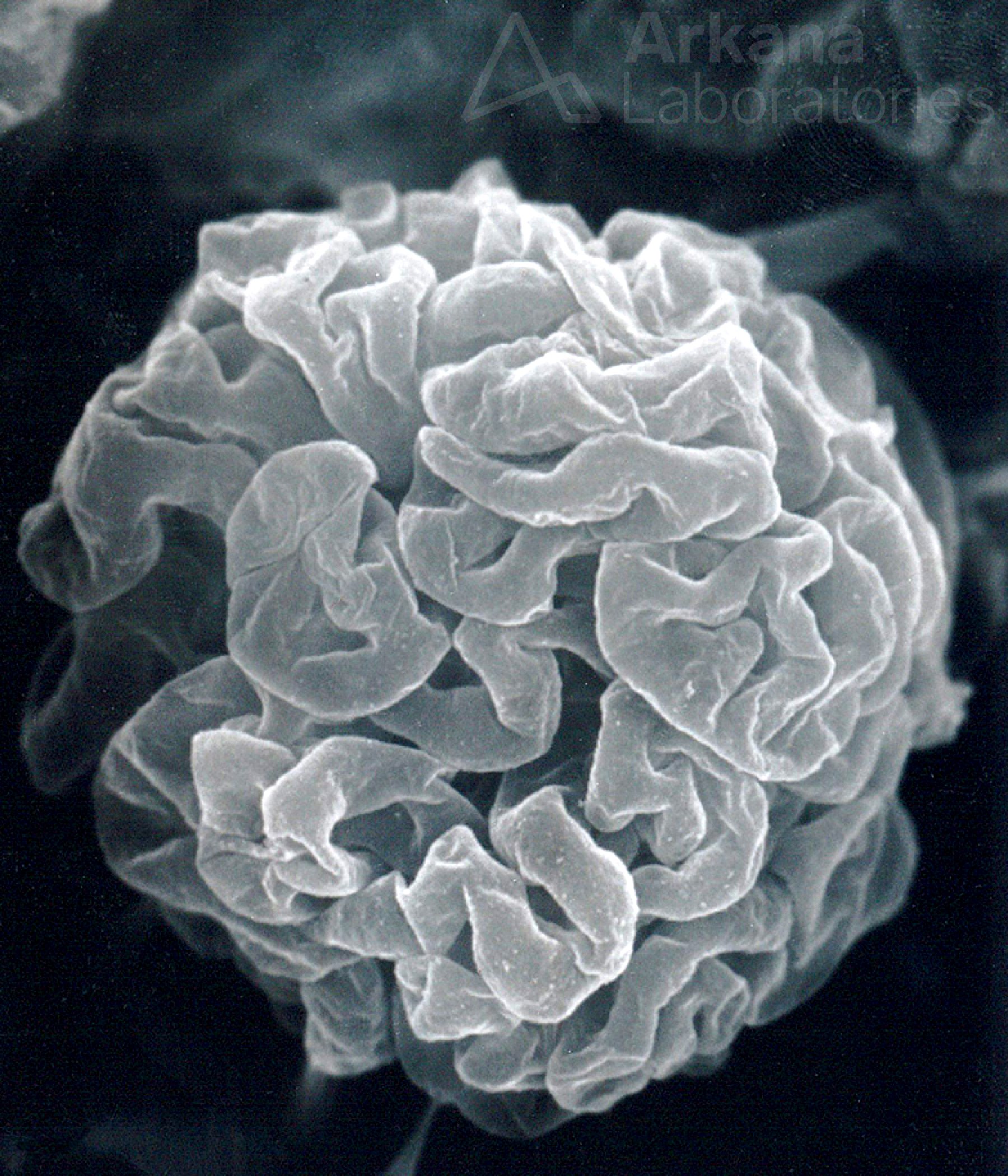 subpodcocytic capillary loop basement membranes following removal of the podocytes