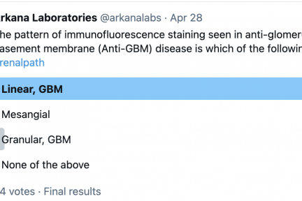 Linear GBM Poll