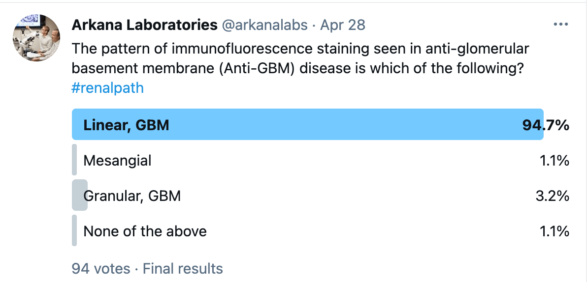 Linear GBM Poll