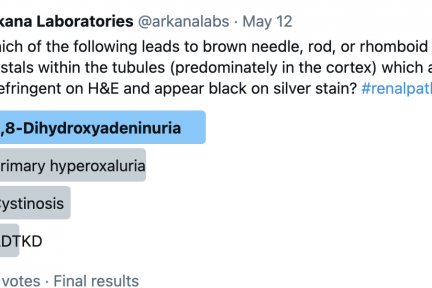 2,8-dihydroxyadeninuria (2,8-DHA) is caused by an autosomal recessive deficiency in the adenine phosphoribosyltransferase (APRT)