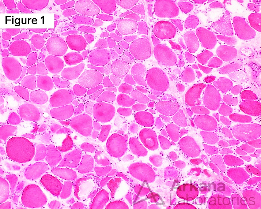 Alkaline Phosphatase in Muscle Biopsies