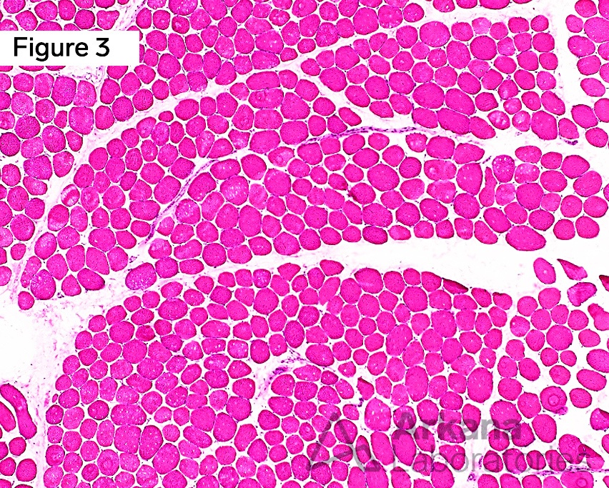 Alkaline Phosphatase in Muscle Biopsies at Arkana Laboratories