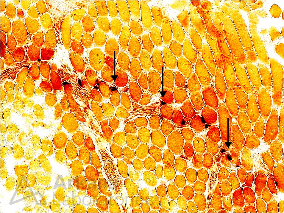 Neuromuscular Junctions Neuro Notes Arkana Laboratories