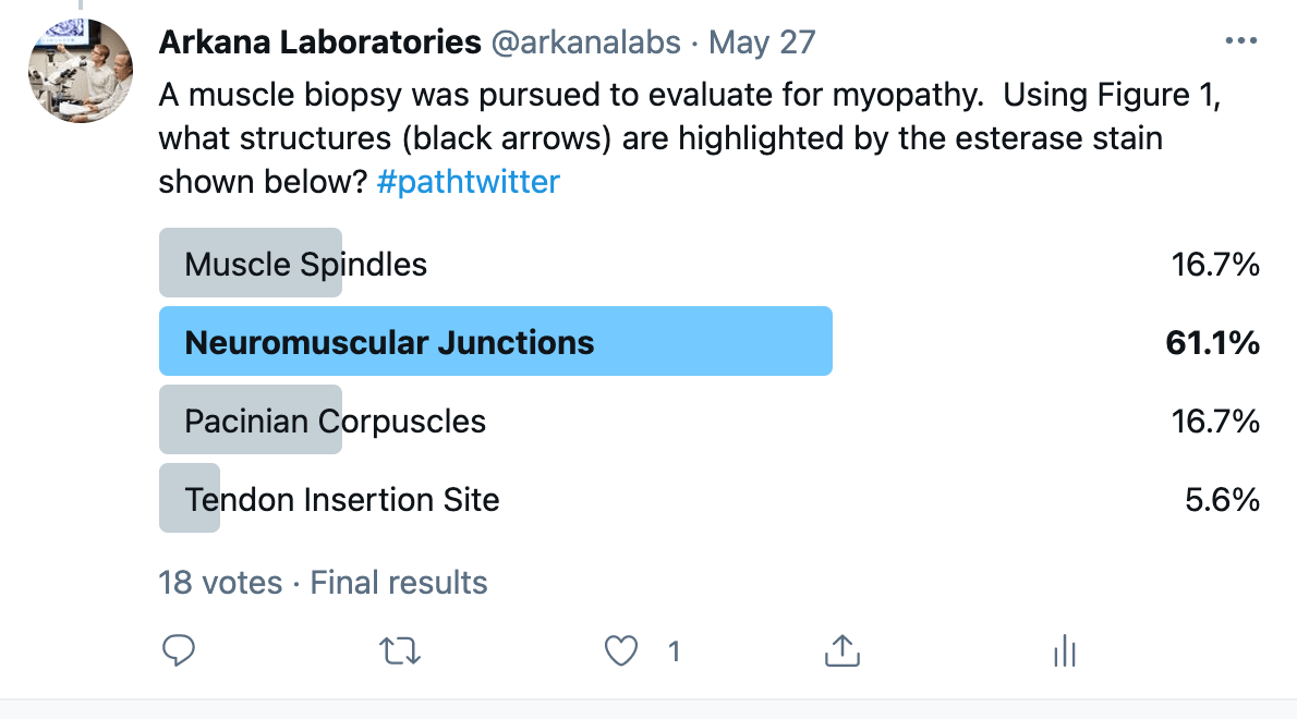 neuromuscular junctions (NMJs) 
