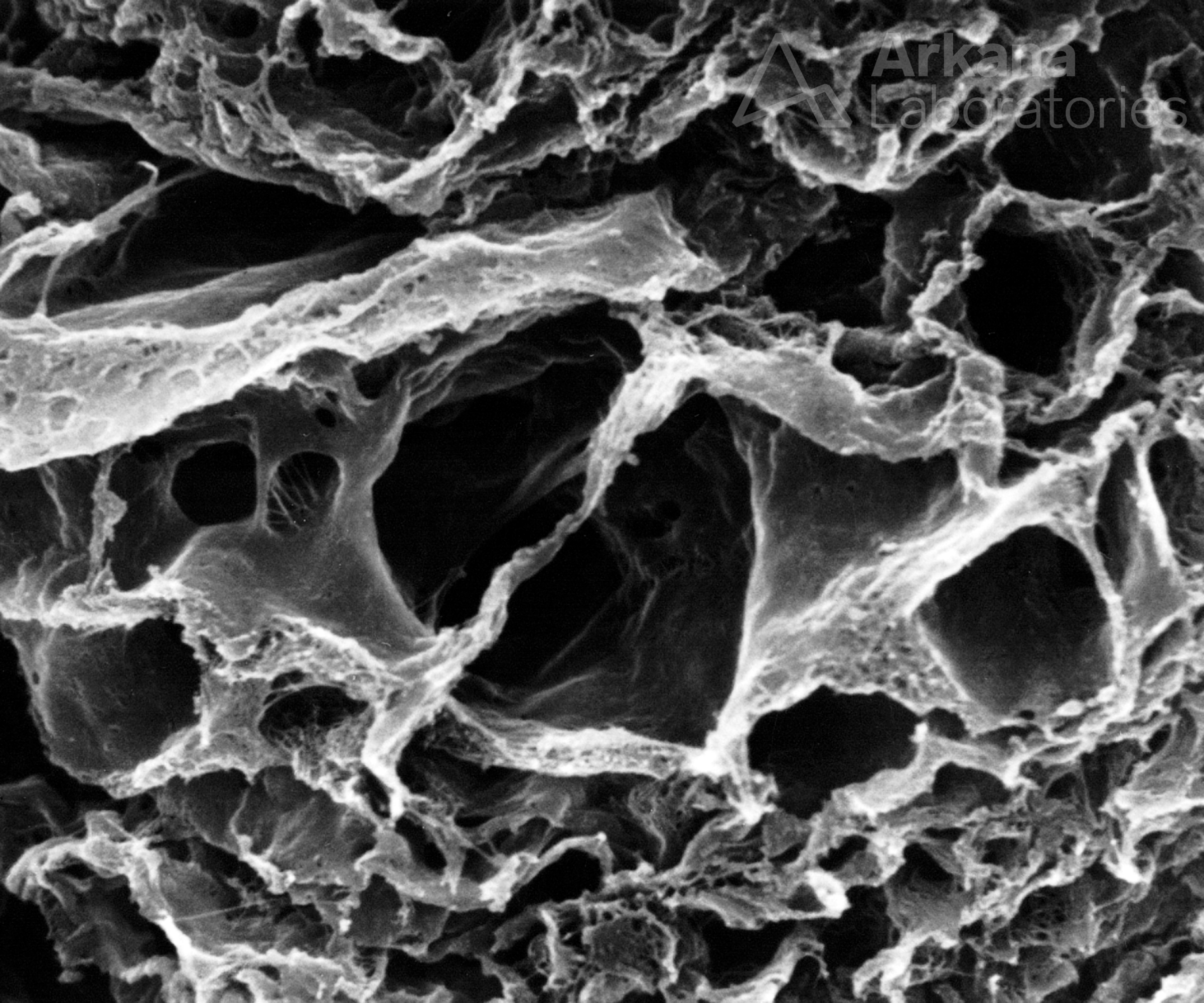 Fibrocellular Crescents with Smooth Basement Membrane Lining Lacunar Spaces