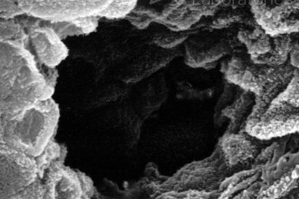 Ostia of a Duct of Bellini, eyeSCANdy, Dr. Stephen Bonsib, renal pathology, 3D EM image