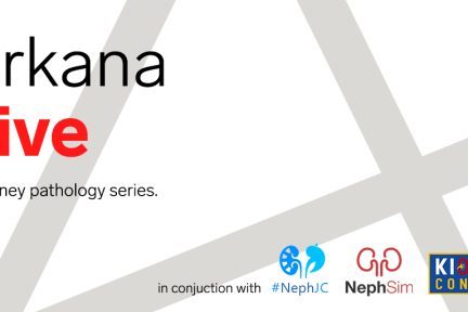 february, Renal Intratubular Casts, january, december, Endocarditis-Related Glomerulonephritis, Infection-Related Glomerulonephritis, Light Microscopy, august, FSGS, september, october, July, Arkana Live, arkana laboratories