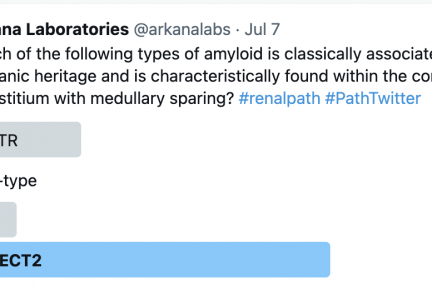 ALECT2 amyloidosis, or leukocyte chemotactic factor 2 amyloidosis makes up less than 10% of all cases of renal amyloidosis