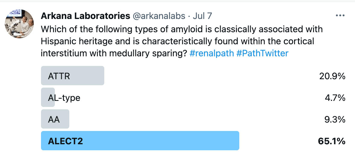 ALECT2 amyloidosis, or leukocyte chemotactic factor 2 amyloidosis makes up less than 10% of all cases of renal amyloidosis