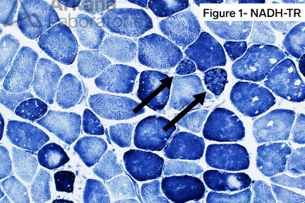 Wedge-shaped Accumulations of Mitochondria