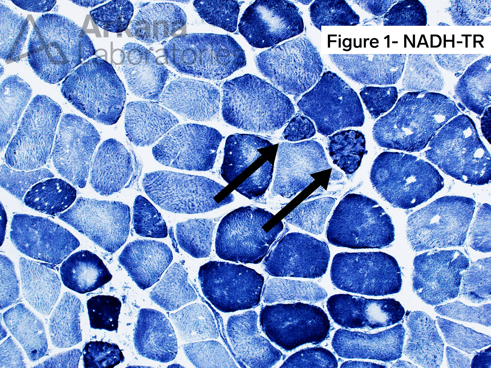 Wedge-shaped Accumulations of Mitochondria