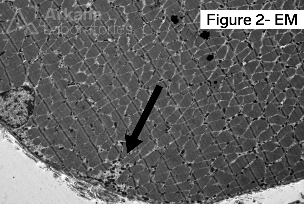 Wedge-shaped Accumulations of Mitochondria