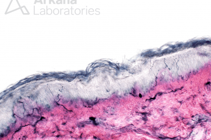 ENFD testing at Arkana Laboratories Neuropathology services
