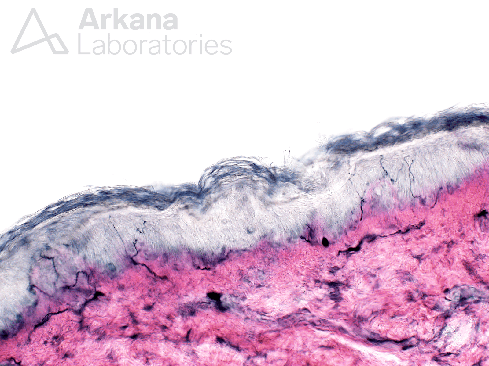 ENFD testing at Arkana Laboratories Neuropathology services