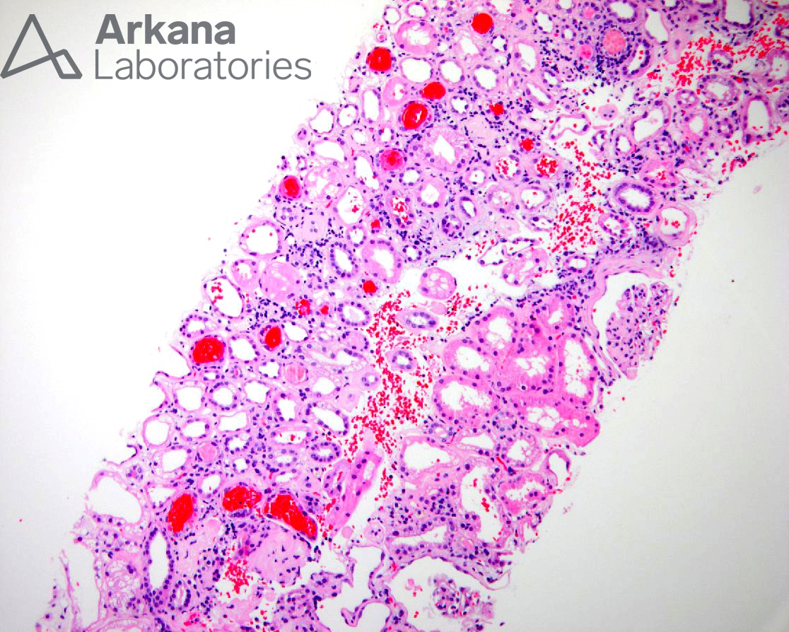 Diagnose This!, anti-Coagulation