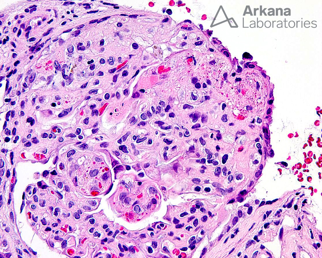 TMAF pathology report, Diagnose This!, Arkana Laboratories