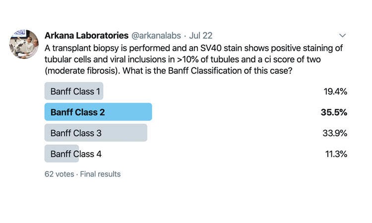 Polyomavirus Nephropathy, Banff Class 3, Twitter Poll, Arkana Laboratories