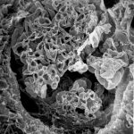 Glomerulus Showing Fibrocellular Crescent