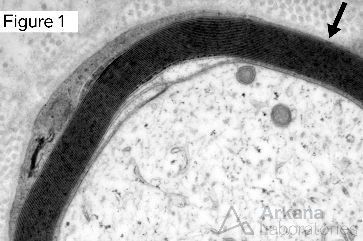 Schwann Cell