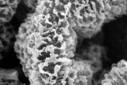 Glomerular Basement Membranes, Subepithelial deposits