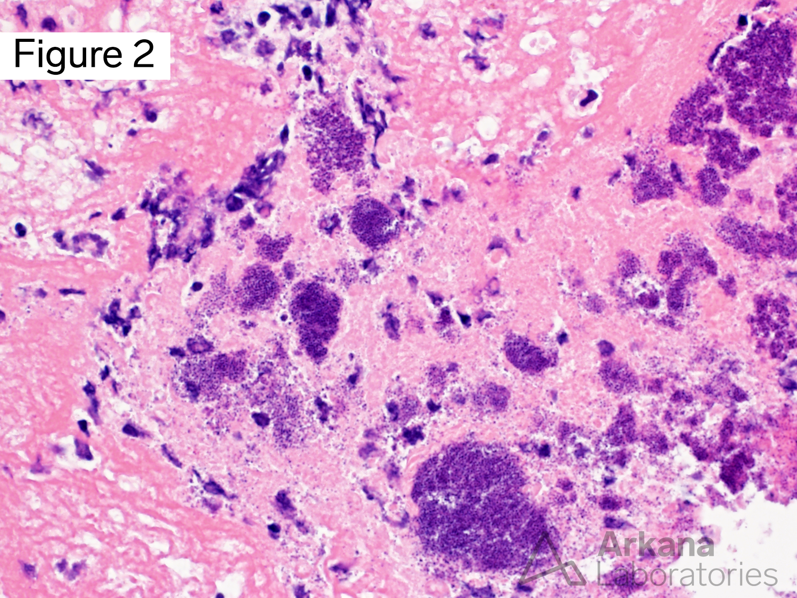 bacterial cocci in clusters