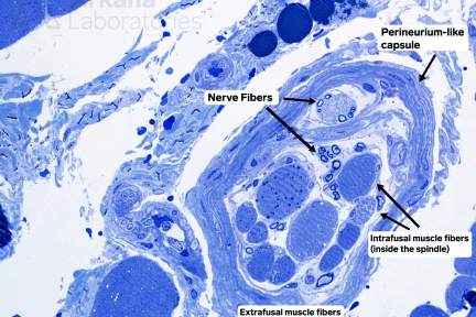 Muscle fiber spindle, nerve fibers