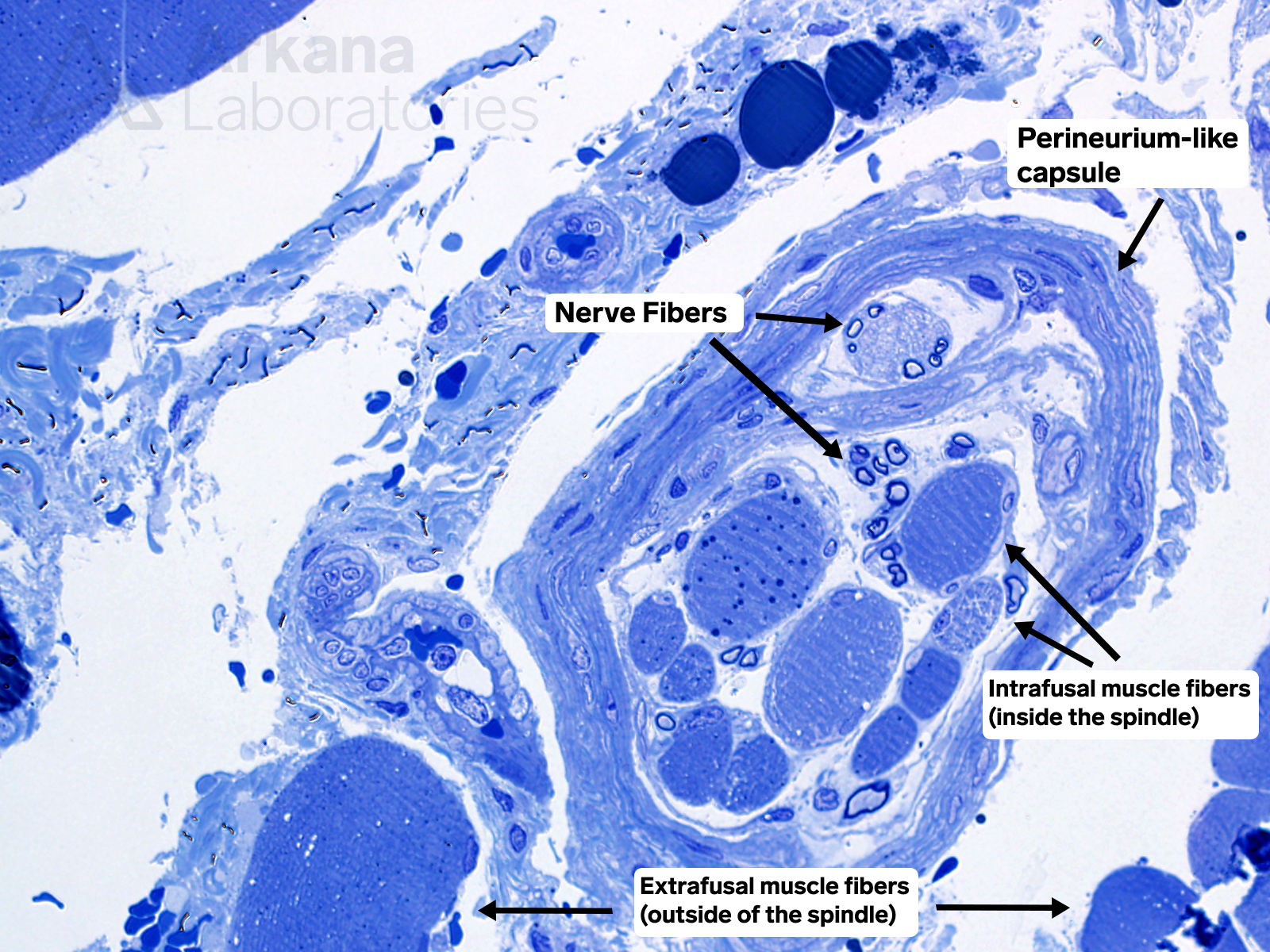 Muscle fiber spindle, nerve fibers