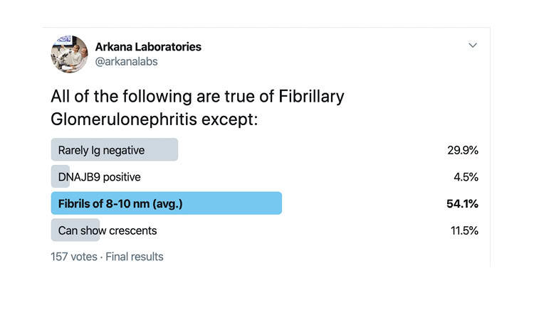 Fibrillary glomerulonephritis, arkana laboratories, twitter poll