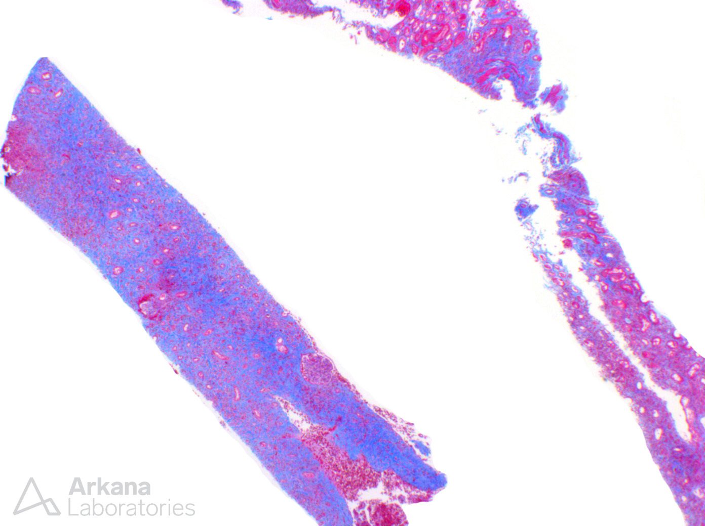 IgG4-related disease