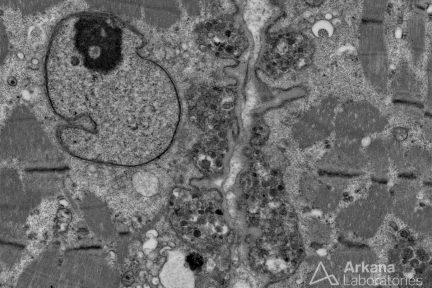 Exocytosis, Neuro Notes, arkana laboratories, muscle biopsy