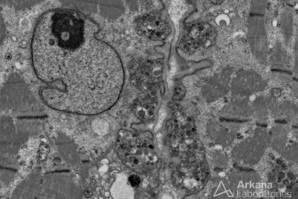 Exocytosis, Neuro Notes, arkana laboratories, muscle biopsy