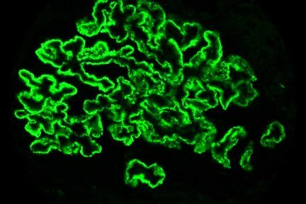 Immunohistochemical staining for PLA2R